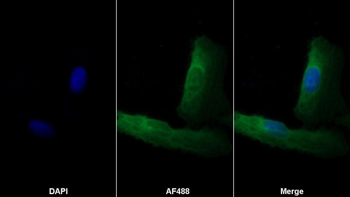 Transforming Growth Factor Beta 1 (TGFb1) Monoclonal Antibody - image 2