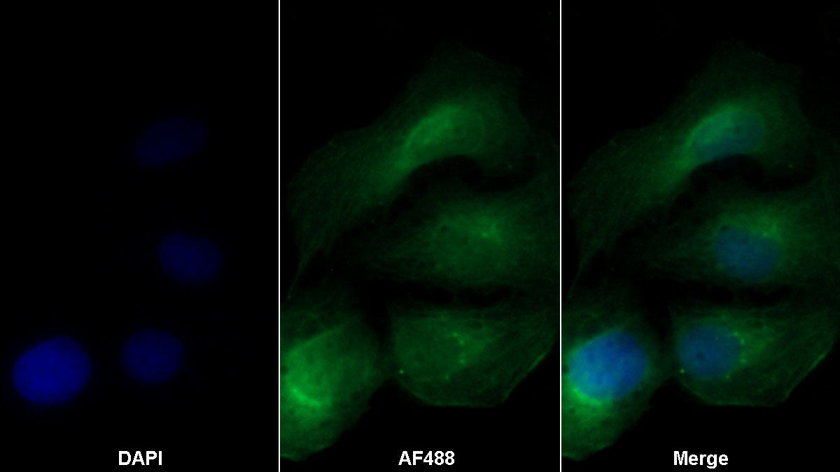 Transforming Growth Factor Beta 1 (TGFb1) Monoclonal Antibody - image 2