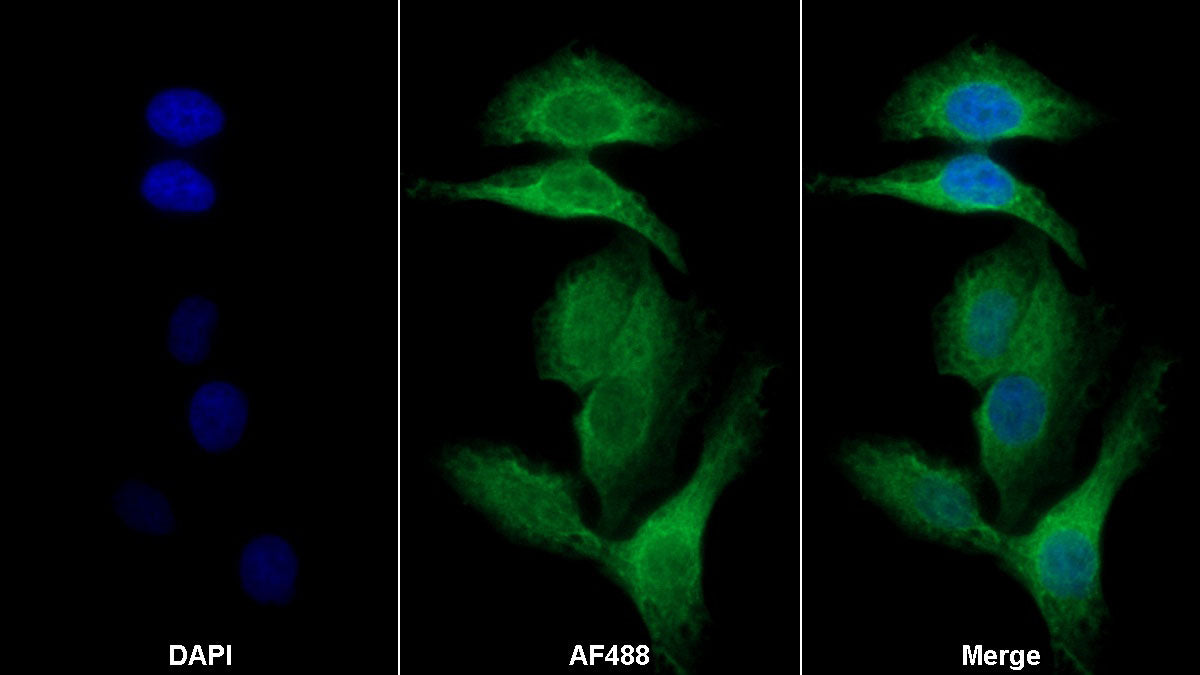 5-Lipoxygenase (5-LO) Monoclonal Antibody - image 2