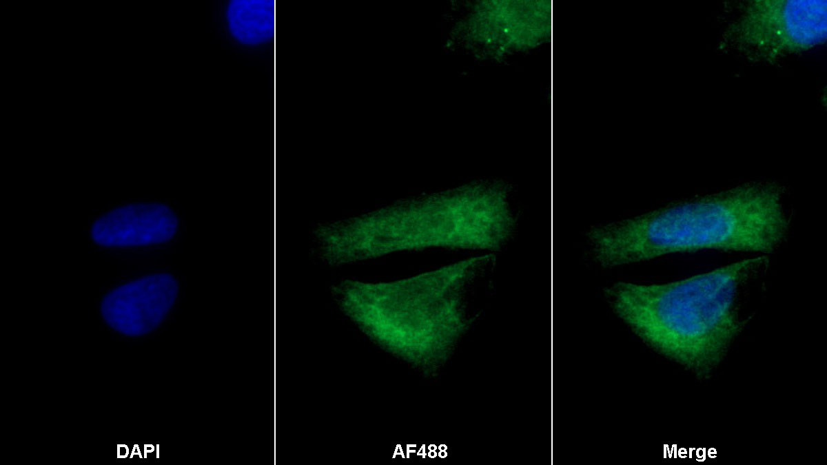 5-Lipoxygenase (5-LO) Monoclonal Antibody - image 2