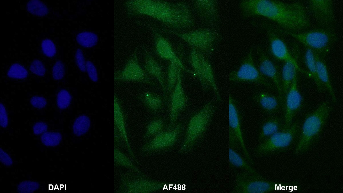 Ceruloplasmin (CP) Monoclonal Antibody - image 2
