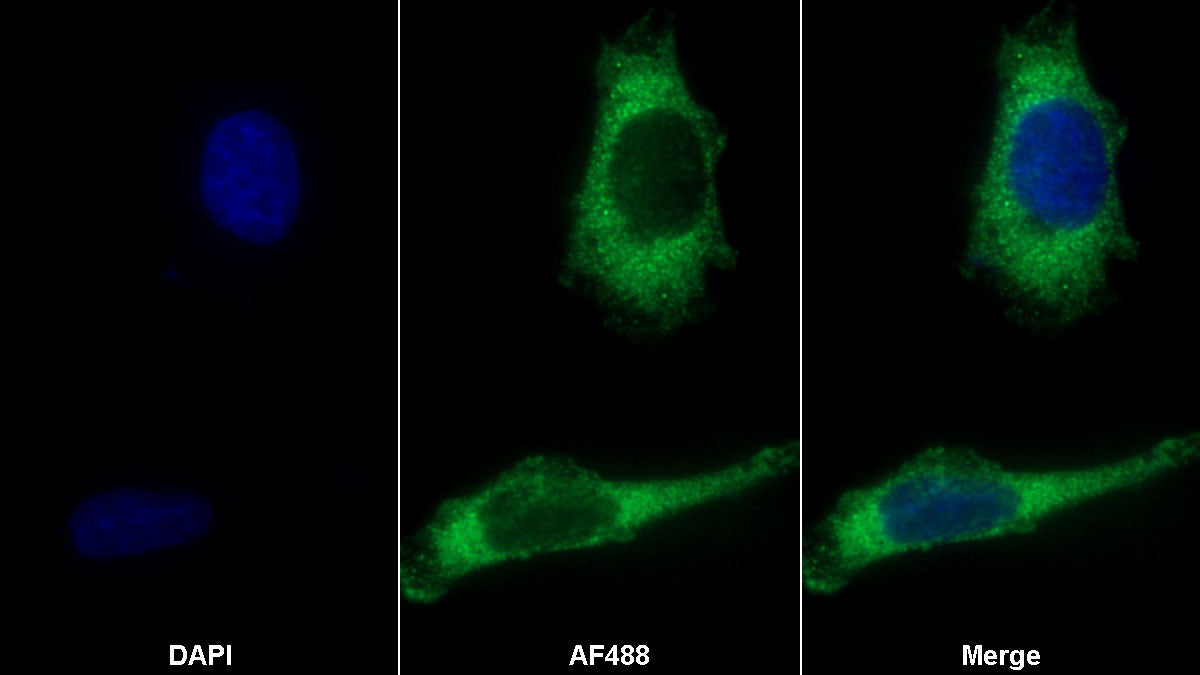 Dickkopf Related Protein 1 (DKK1) Monoclonal Antibody - image 2