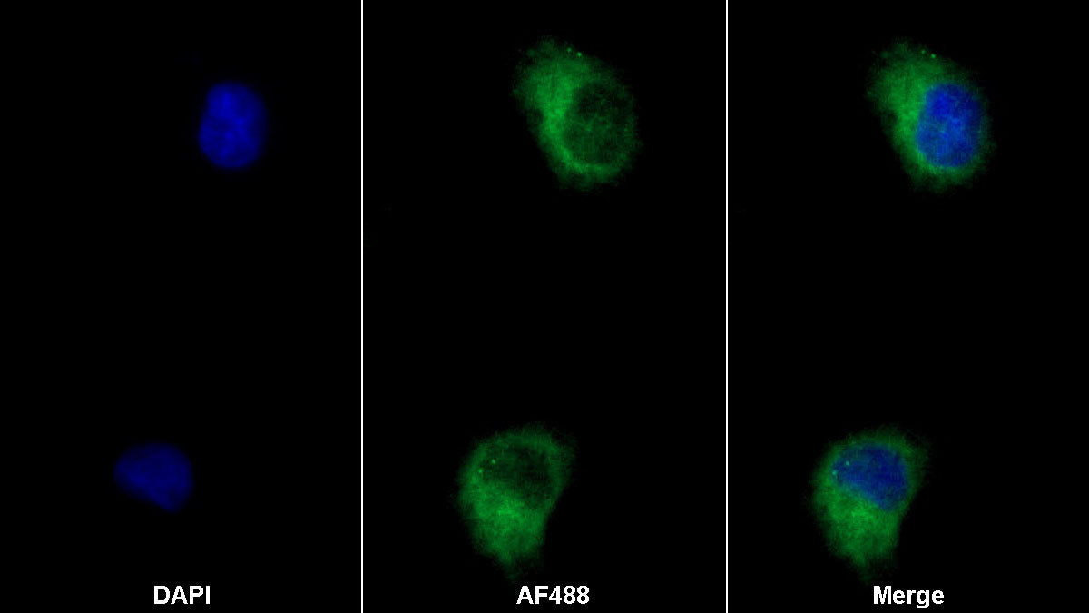 Interleukin 12 Receptor Beta 1 (IL12Rb1) Monoclonal Antibody - image 2
