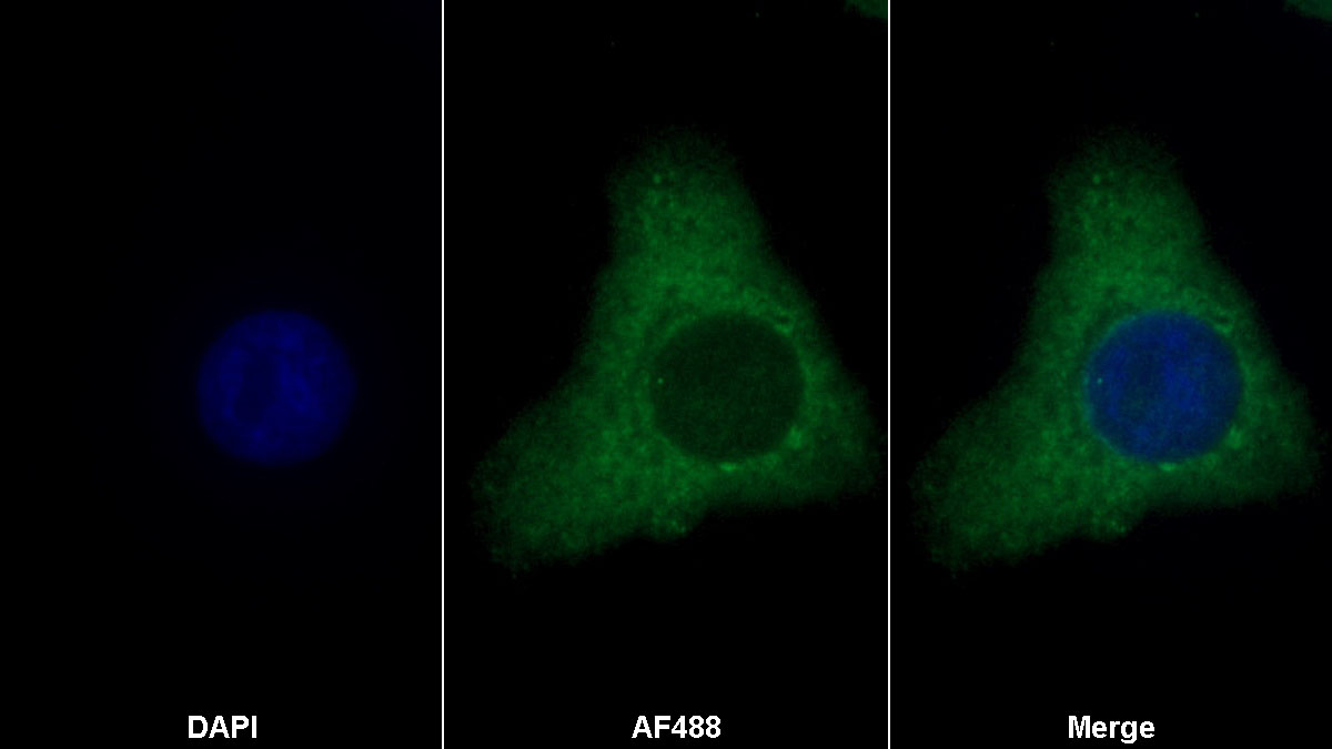Brain Derived Neurotrophic Factor (BDNF) Monoclonal Antibody - image 2