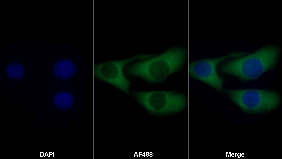 Coagulation Factor IX (F9) Monoclonal Antibody - image 2