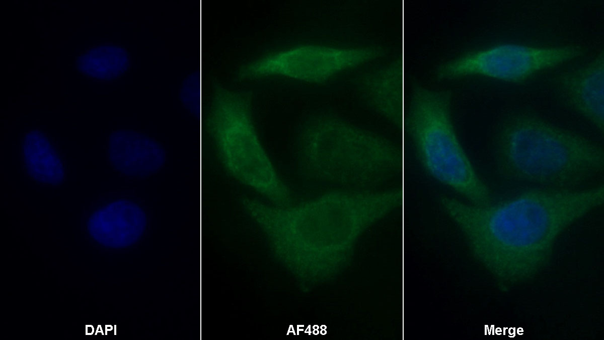 Mesencephalic Astrocyte Derived Neurotrophic Factor (MANF) Monoclonal Antibody - image 2