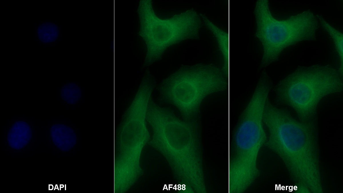 Fibroblast Growth Factor 21 (FGF21) Monoclonal Antibody - image 2