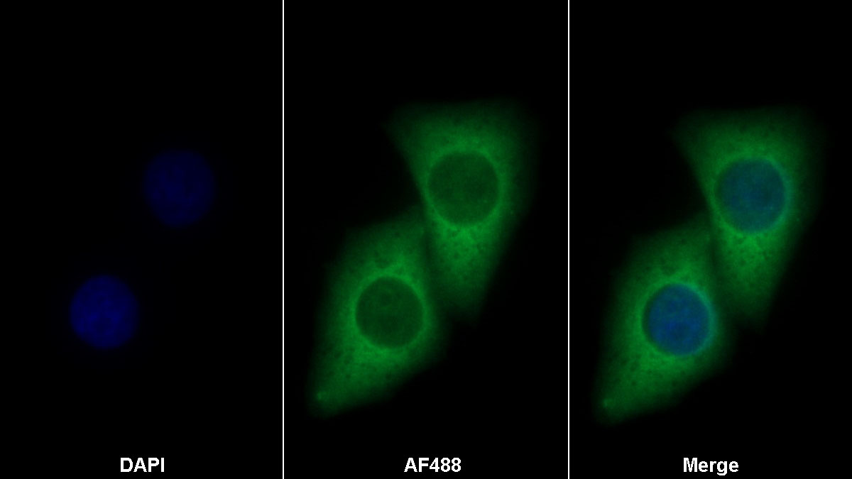Fibroblast Growth Factor 21 (FGF21) Monoclonal Antibody - image 2