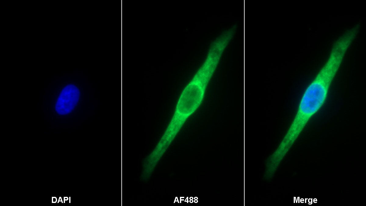 Thymidine Kinase 1, Soluble (TK1) Monoclonal Antibody - image 2