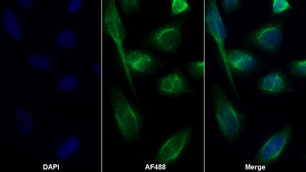 Alpha-1-Antitrypsin (a1AT) Monoclonal Antibody - image 2