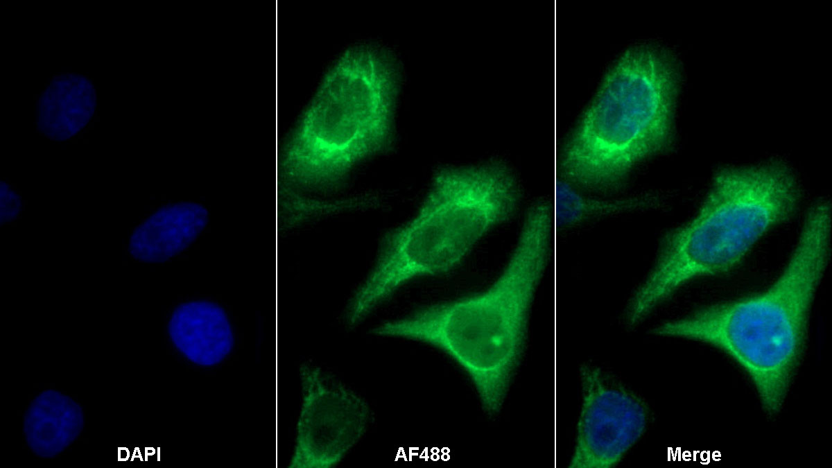 S100 Calcium Binding Protein P (S100P) Monoclonal Antibody - image 2
