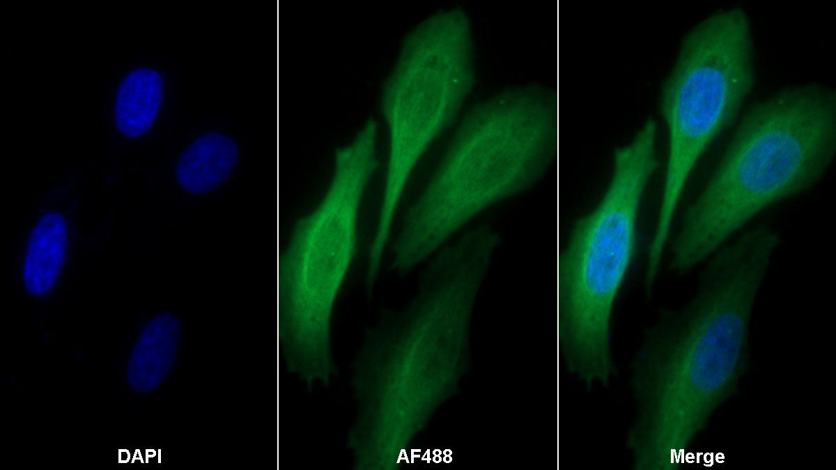 Alpha-1-Acid Glycoprotein (a1AGP) Monoclonal Antibody - image 2