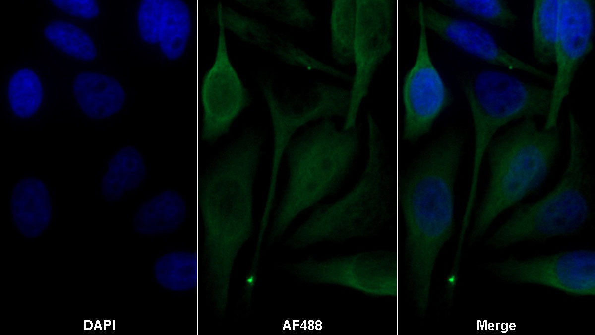 Connective Tissue Growth Factor (CTGF) Monoclonal Antibody - image 2