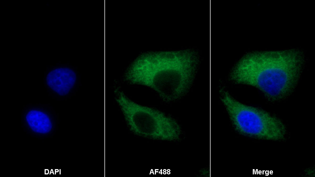 Carbonic Anhydrase IV (CA4) Monoclonal Antibody - image 2