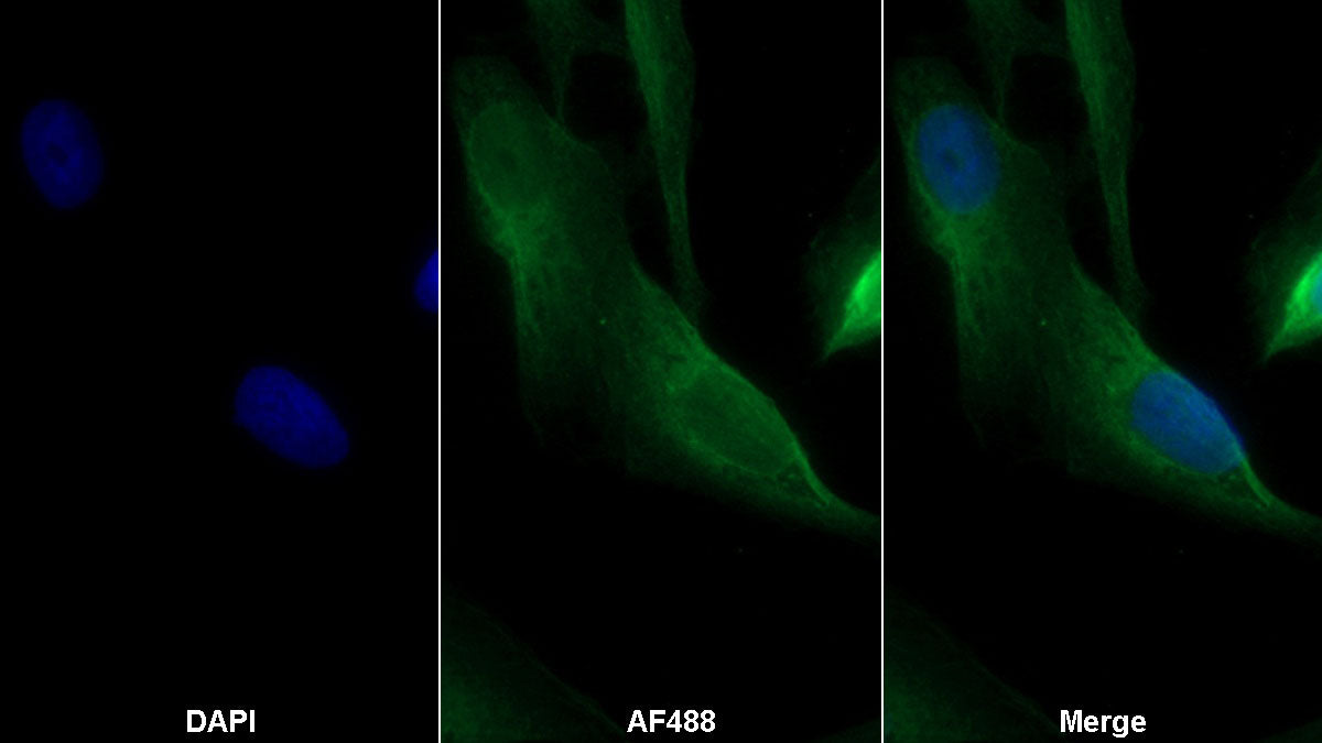 Programmed Cell Death Protein 1 Ligand 2 (PDL2) Monoclonal Antibody - image 2