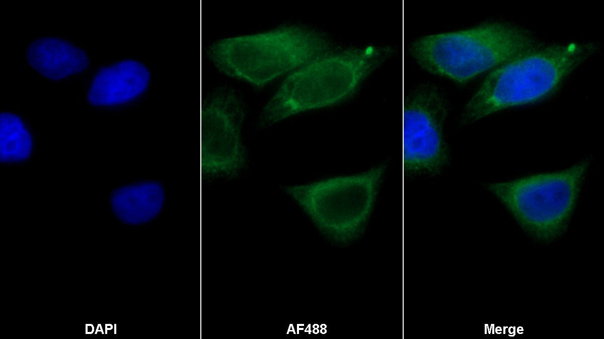 Tissue Plasminogen Activator (tPA) Monoclonal Antibody - image 2