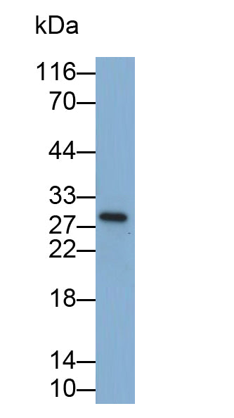Interleukin 35 (IL35) Monoclonal Antibody - image 3