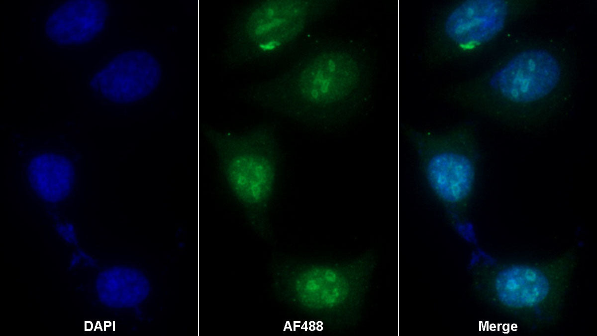 Ki-67 Protein (Ki-67) Monoclonal Antibody - image 2