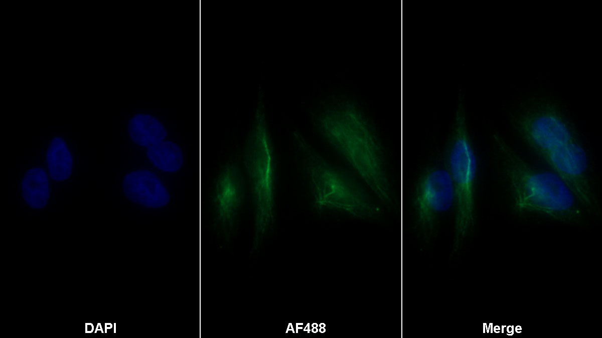 Alpha-Lactalbumin (aLA) Monoclonal Antibody - image 2