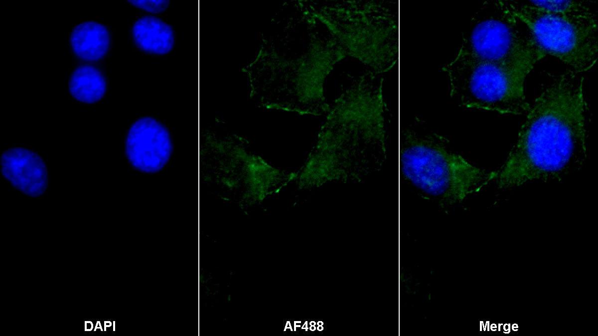 Actin Alpha 2, Smooth Muscle (ACTa2) Monoclonal Antibody - image 2