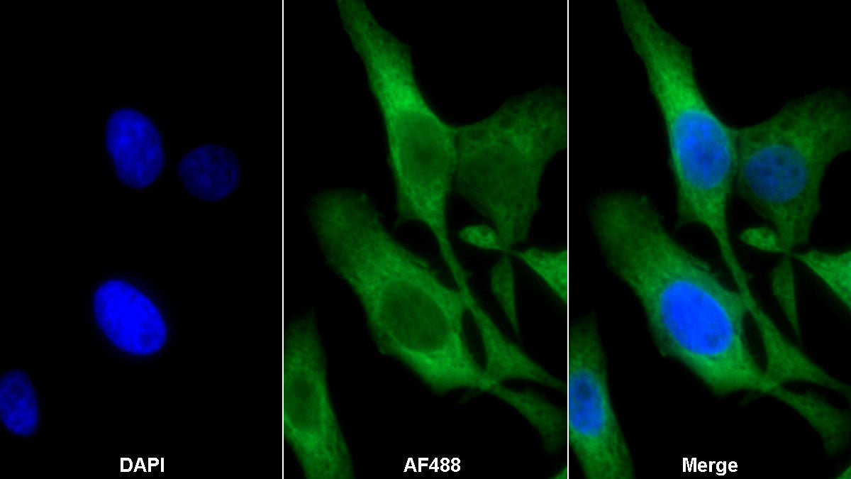 Western Blot; Samples: Lane1: A549 cell lysate; Lane2: 293T cell lysate; Lane3: NIH/3T3 cell lysate; Lane4: Rat Cerebrum lysate; Primary Ab: 0.2ug/ml Mouse Anti-Human PKM2 Antibody; Second Ab: 0.2ug/ml HRP-Linked Caprine Anti-Mouse IgG Polyclonal Antibody