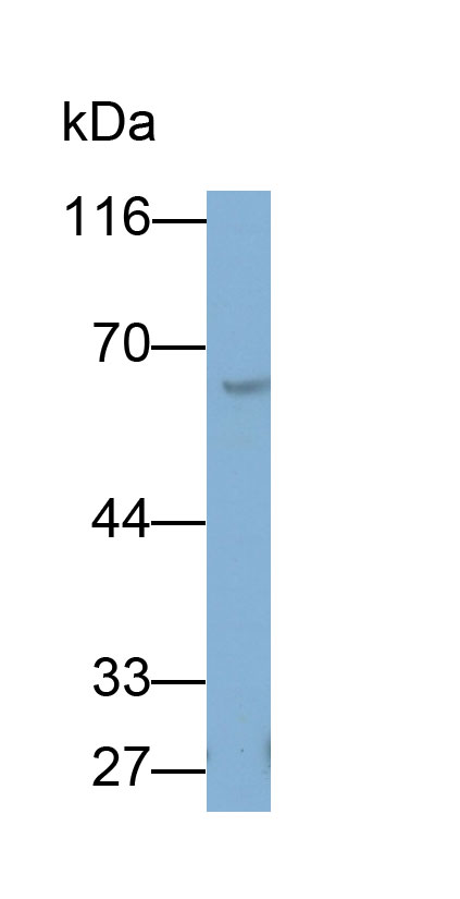 Pyruvate kinase isozymes M2 (PKM2) Monoclonal Antibody - image 2