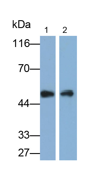 Peripherin (PRPH) Polyclonal Antibody - image 2