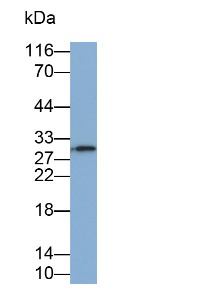Interleukin 35 (IL35) Monoclonal Antibody - image 3