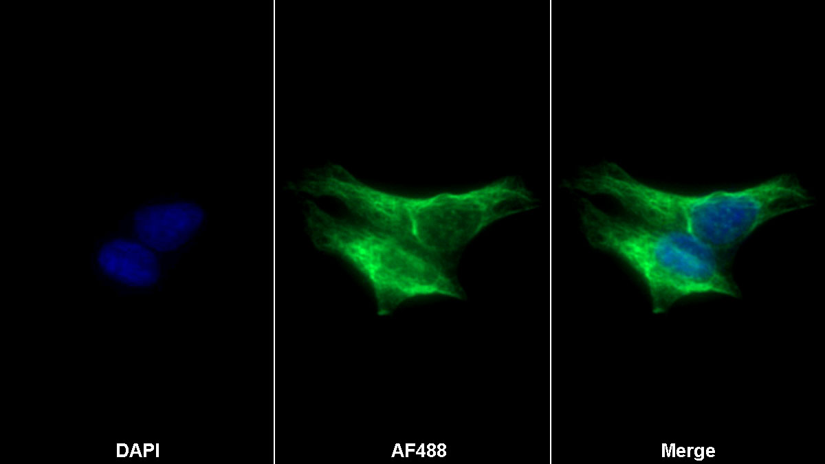 Human SH-SY5Y cell line was fixed with 2% paraformaldehyde