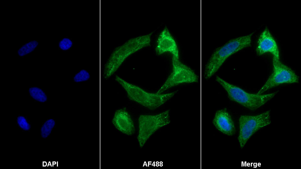 Connective Tissue Growth Factor (CTGF) Monoclonal Antibody - image 2