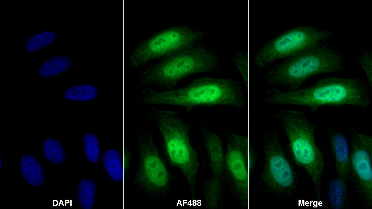 S100 Calcium Binding Protein P (S100P) Monoclonal Antibody - image 2