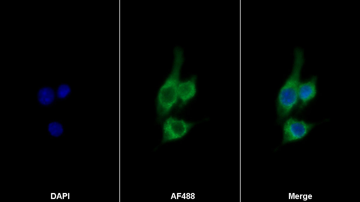 Colony Stimulating Factor Receptor, Macrophage (MCSFR) Monoclonal Antibody - image 2