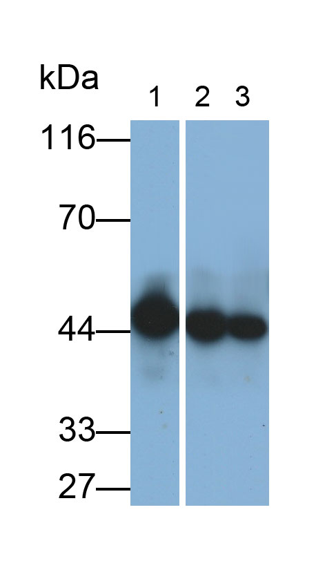 Acyl Coenzyme A Dehydrogenase, Long Chain (ACADL) Polyclonal Antibody - image 2