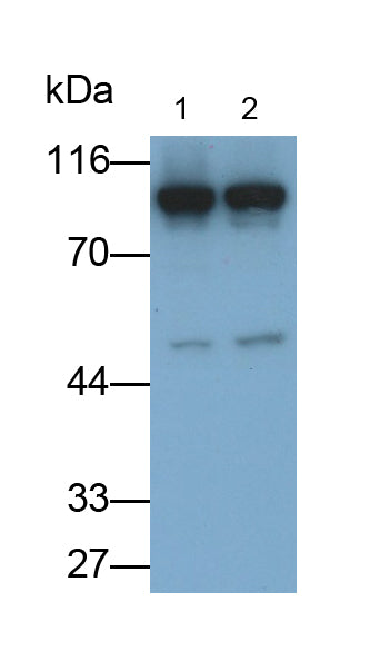 Adenosine Monophosphate Deaminase 2 (AMPD2) Polyclonal Antibody - image 3