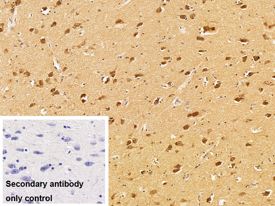 Amyloid Beta Peptide 1-40 (Ab1-40) Polyclonal Antibody - image 2