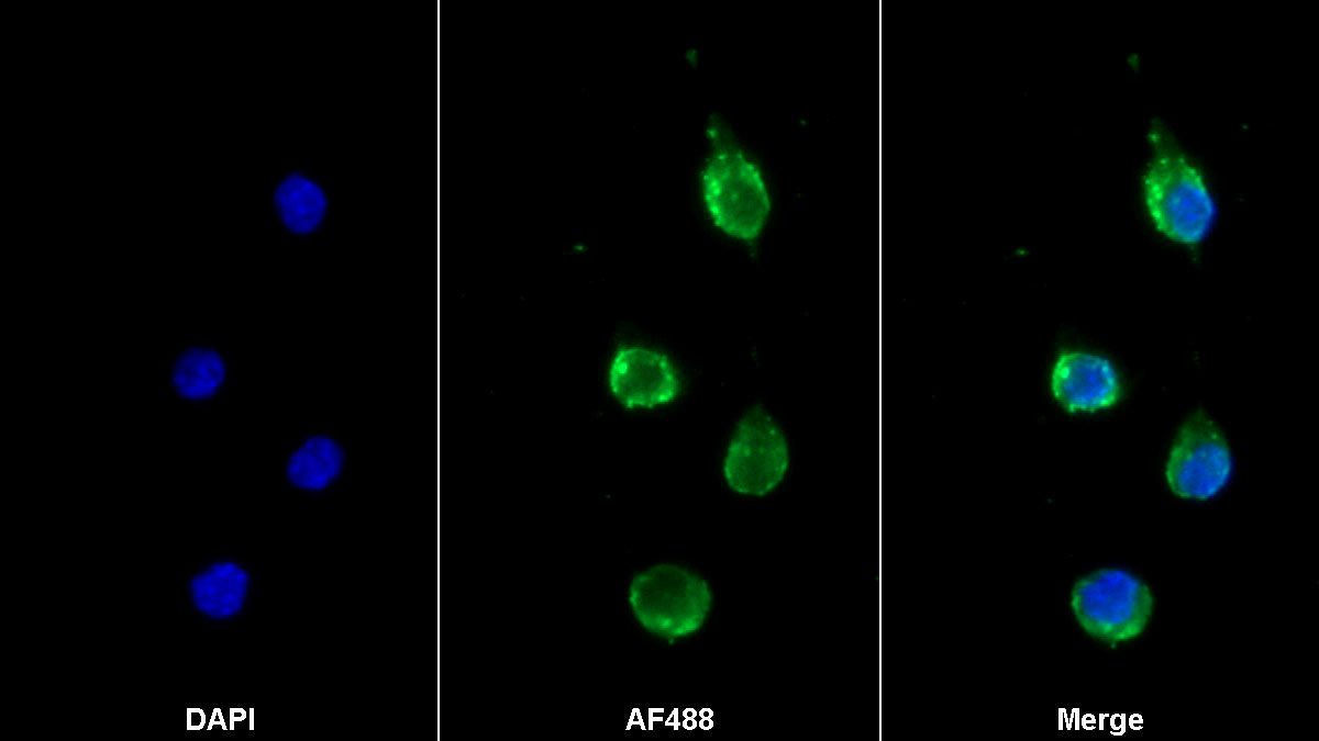 Toll Like Receptor 1 (TLR1) Monoclonal Antibody - image 2