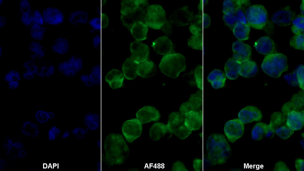 Target Of The Antiproliferative Antibody 1 (TAPA1) Monoclonal Antibody - image 2