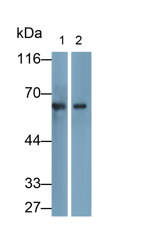 Catalase (CAT) Monoclonal Antibody - image 2
