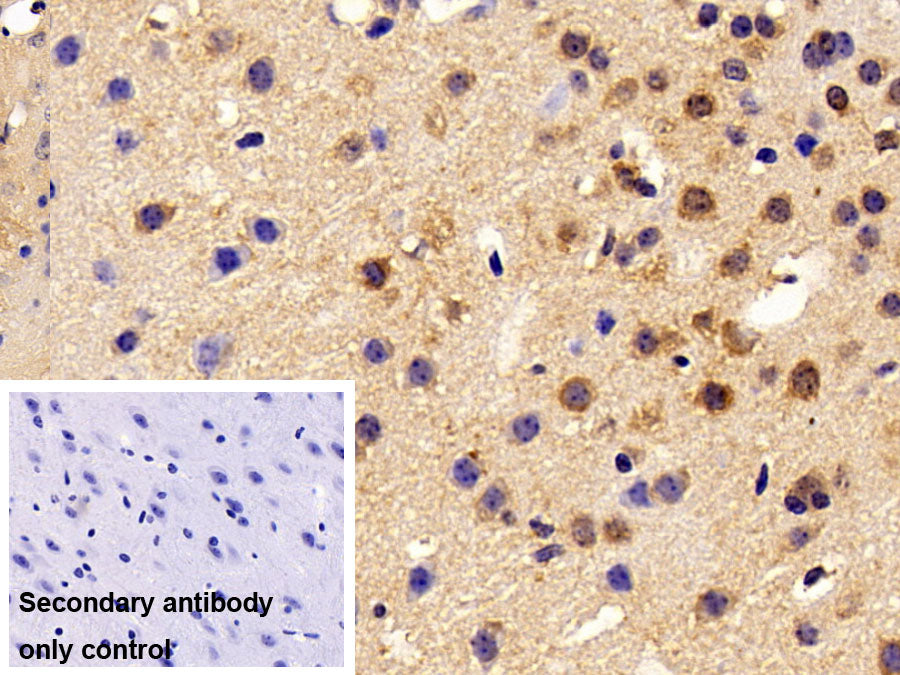 DAB staining on IHC-P; Sample: Mouse Stomach Tissue; Primary Ab: 10ug/ml Rabbit Anti-Mouse APC Antibody; Control: Used PBS instead of primary antibody; Second Ab: 2ug/ml HRP-Linked Caprine Anti-Rabbit IgG Polyclonal Antibody