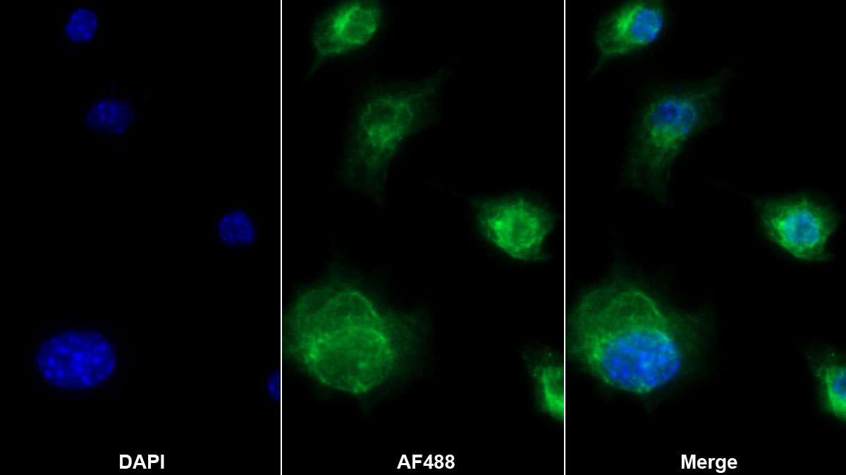 Interleukin 1 Beta (IL1b) Monoclonal Antibody - image 2