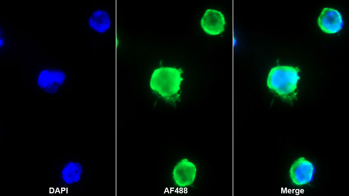 Hemojuvelin (HJV) Monoclonal Antibody - image 2
