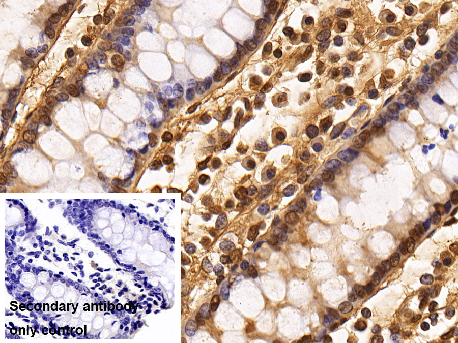 DAB staining on IHC-P; Sample: Porcine Small intestine Tissue; Primary Ab: 20ug/ml Mouse Anti-Human HDAC1 Antibody; Control: Used PBS instead of primary antibody; Second Ab: 2ug/ml HRP-Linked Caprine Anti-Mouse IgG Polyclonal Antibody