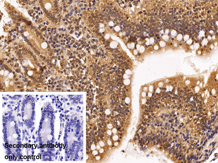 DAB staining on IHC-P; Sample: Porcine Lymph node Tissue; Primary Ab: 20ug/ml Mouse Anti-Human HDAC1 Antibody; Control: Used PBS instead of primary antibody; Second Ab: 2ug/ml HRP-Linked Caprine Anti-Mouse IgG Polyclonal Antibody
