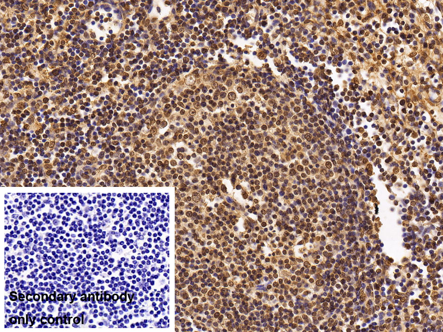 Western Blot; Samples: Lane1: Human Lung lysate; Lane2: A549 cell lysate; Lane3: HepG2 cell lysate; Primary Ab: 0.2ug/ml Mouse Anti-Human HDAC1 Antibody; Second Ab: 0.2ug/ml HRP-Linked Caprine Anti-Mouse IgG Polyclonal Antibody