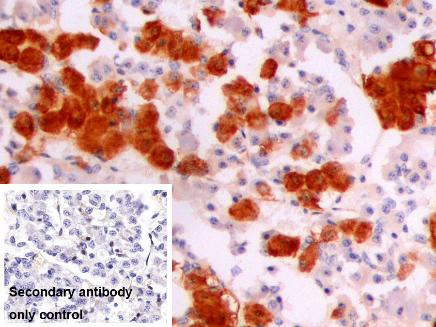 Alpha-Melanocyte Stimulating Hormone (aMSH) Monoclonal Antibody - image 2