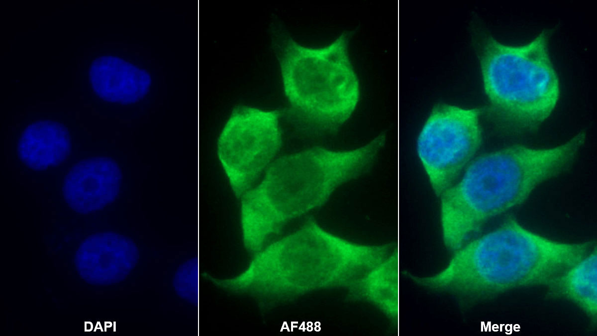 Androgen Receptor (AR) Monoclonal Antibody - image 2