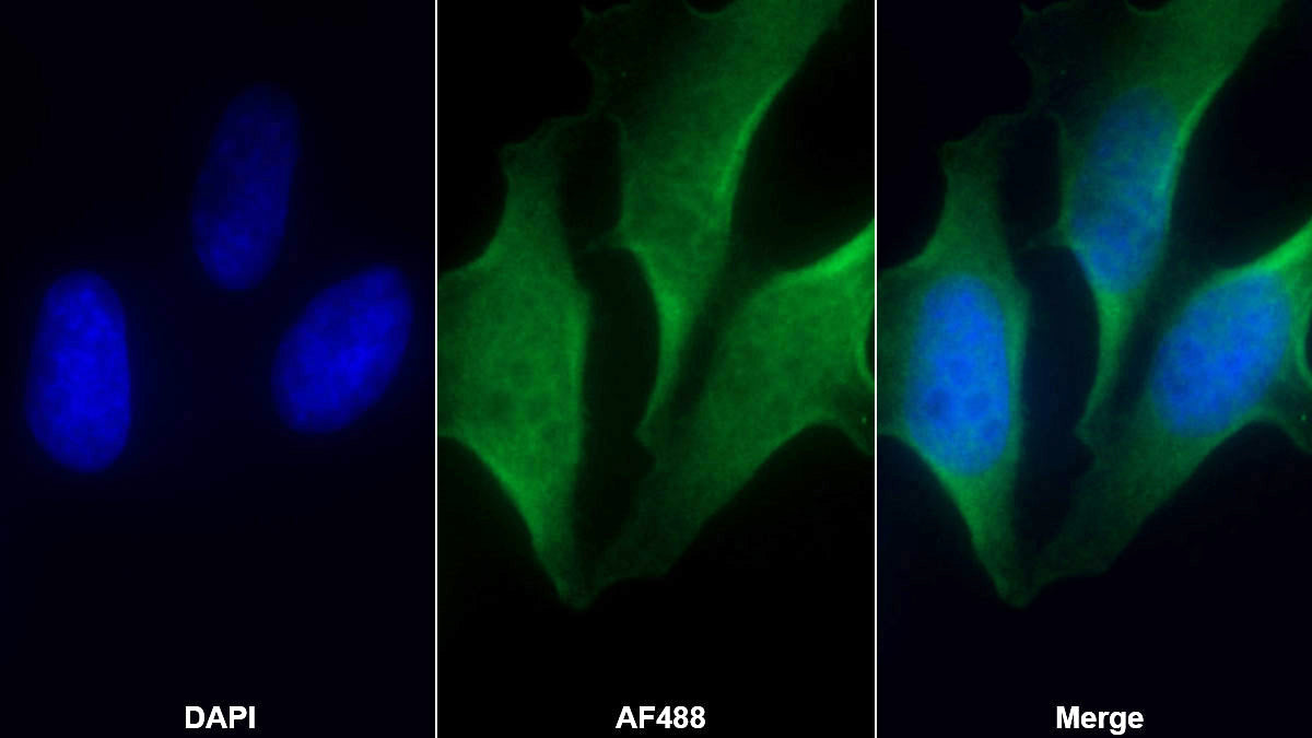 Vascular Cell Adhesion Molecule 1 (VCAM1) Monoclonal Antibody - image 2