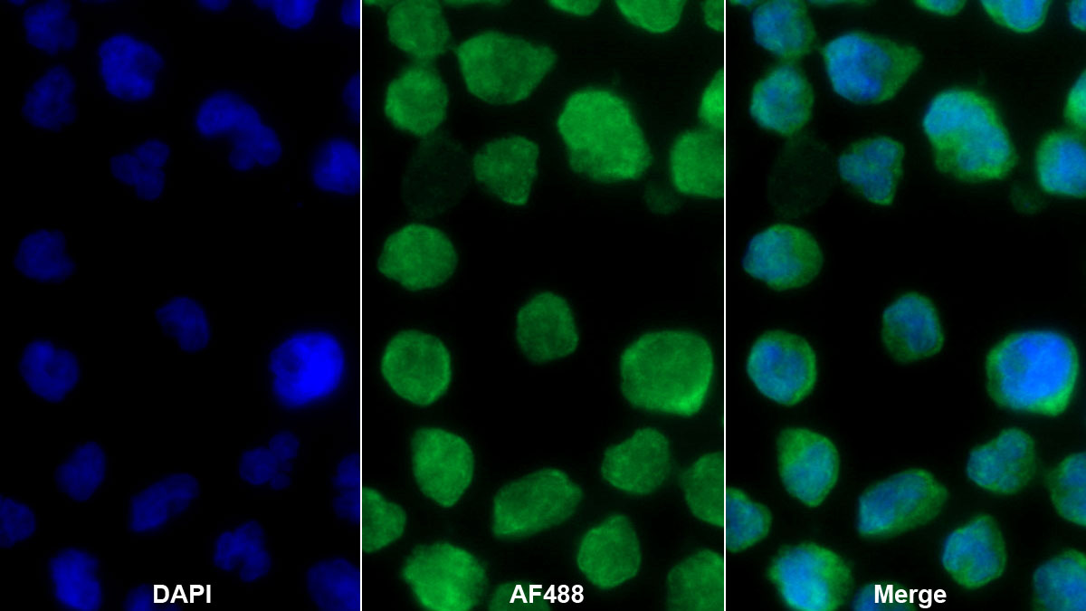 Interleukin 19 (IL19) Monoclonal Antibody - image 2