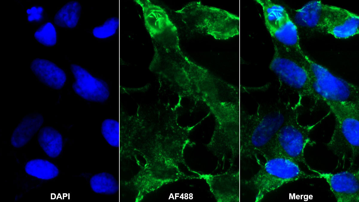 Cluster Of Differentiation 56 (CD56) Polyclonal Antibody - image 2