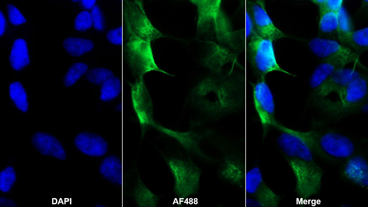 Purinergic Receptor P2X, Ligand Gated Ion Channel 7 (P2RX7) Monoclonal Antibody - image 2